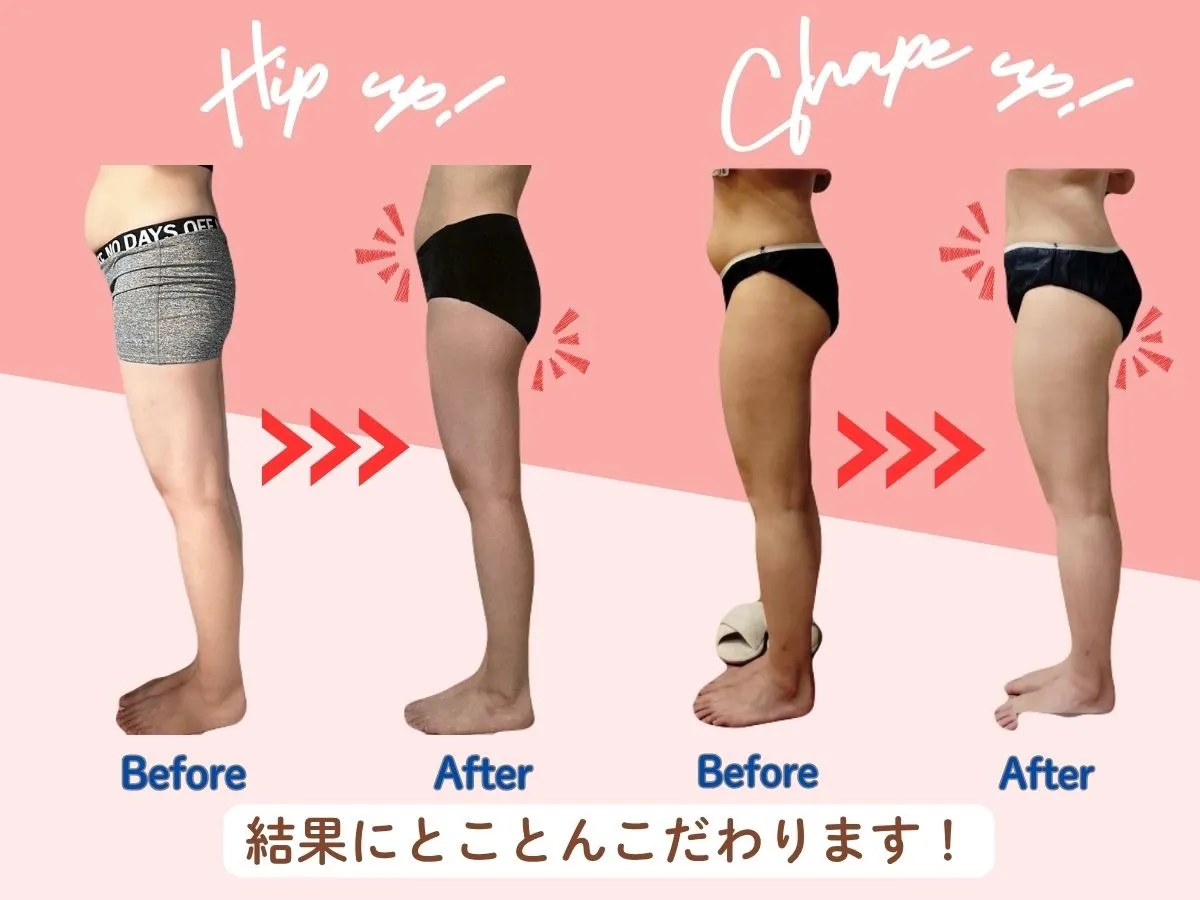 見た目痩せ！BeforeAfter1
