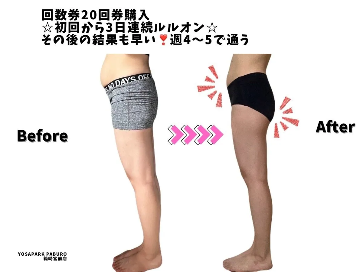  見た目痩せ！BeforeAfter2