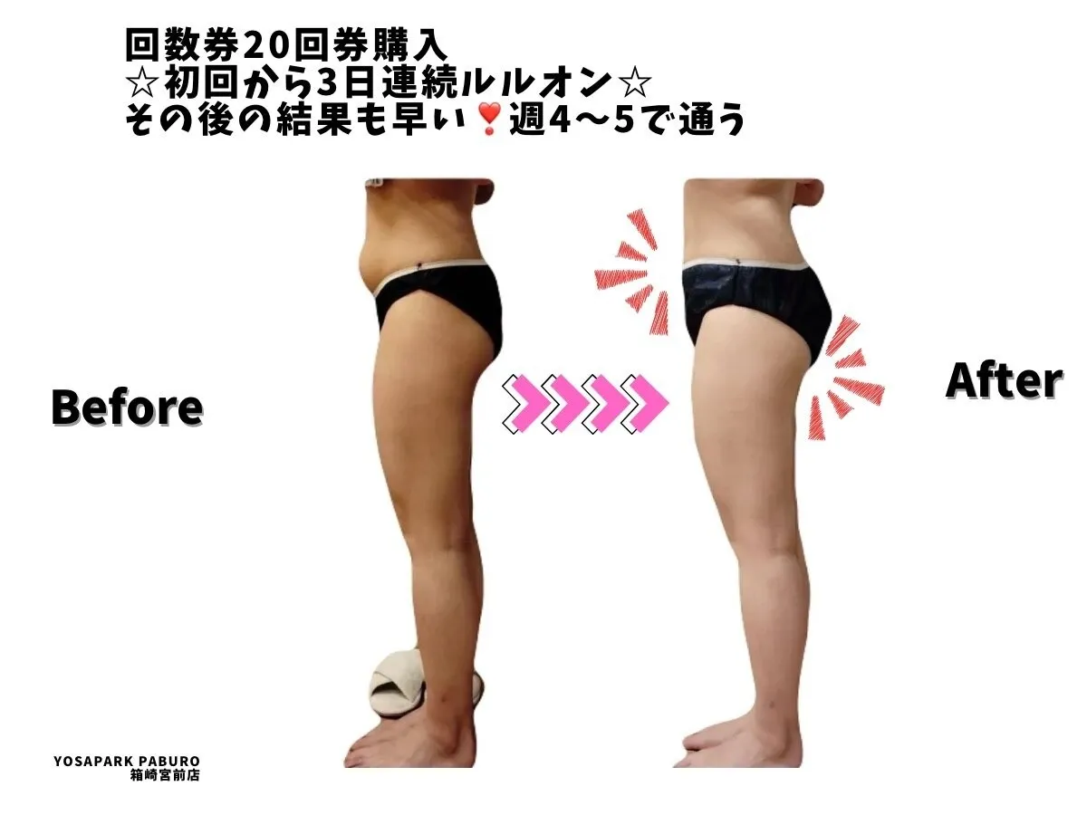 見た目痩せ！BeforeAfter2